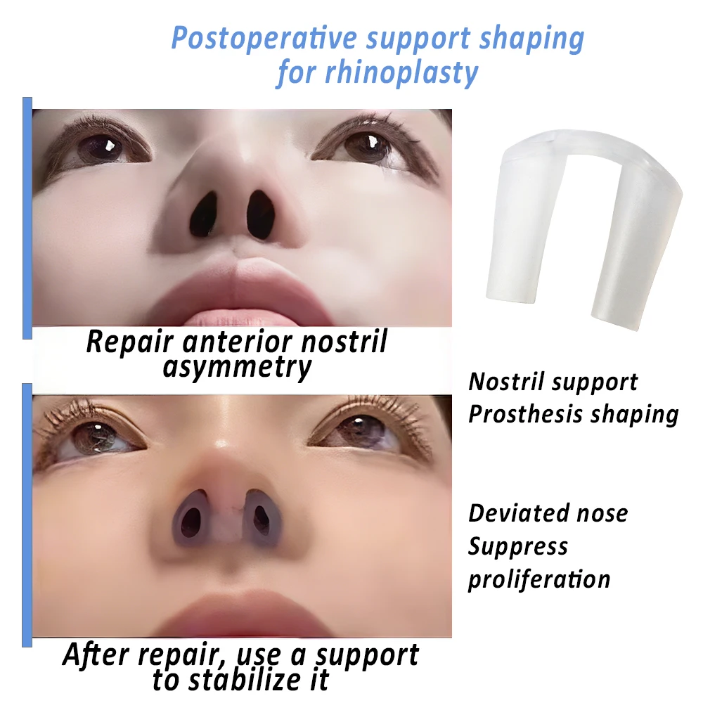 수술 후 코 성형술 콧구멍 지지 실리콘 성형 교정기 코 - Anti Snore Contour Pillow 리뷰 및 가격